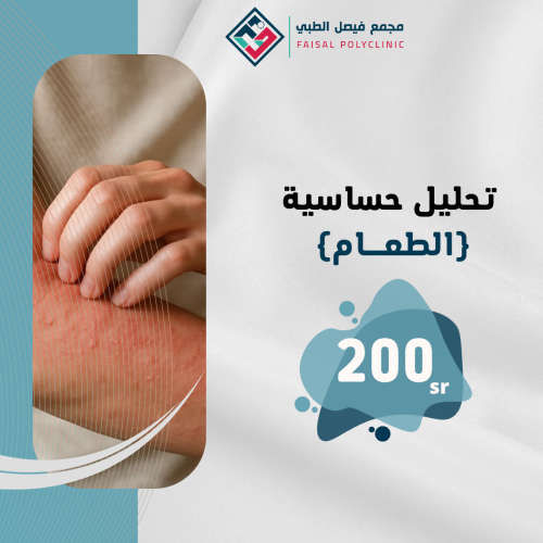 تحليل حساسية الطعام