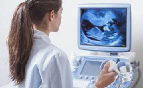 سونار 5 شهور من الحمل