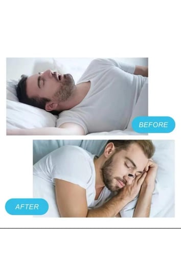 موسع الأنف الرياضي والمريح وتقليل الشخير وتحسين جو...