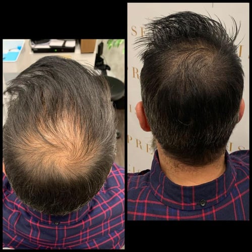 Powerful Hair Tonic التونك البرازيلي لتطويل وتكثيف...