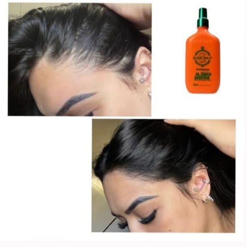Powerful Hair Tonic التونك البرازيلي لتطويل وتكثيف...
