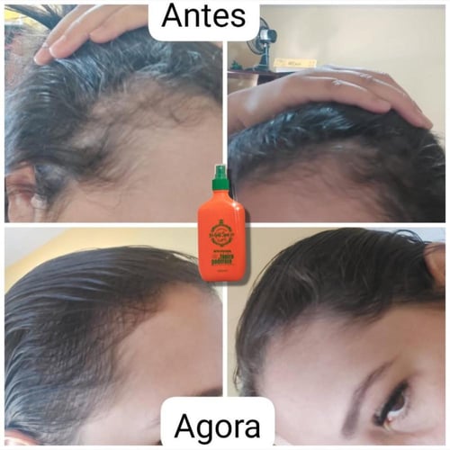 Powerful Hair Tonic التونك البرازيلي لتطويل وتكثيف...