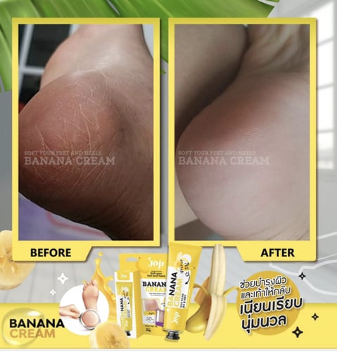كريم جوجي سيكريت يونج سوفت بالموز للعناية بالقدمين