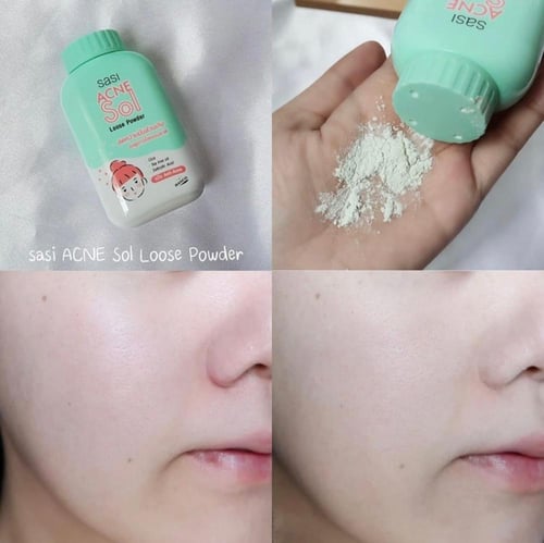 بودرة منثوره - حب الشباب