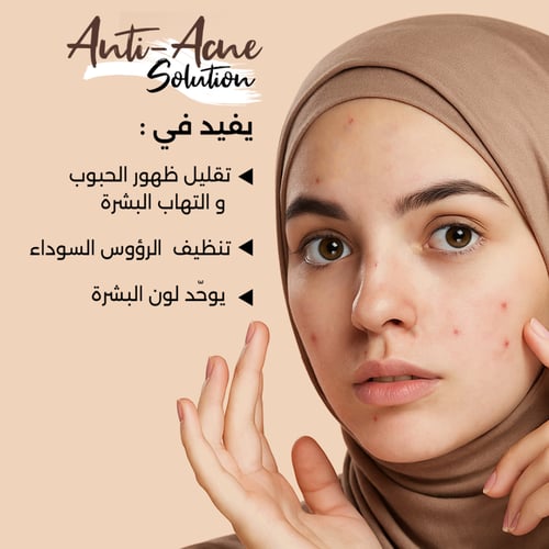 محلول مضاد لحب الشباب - 30مل