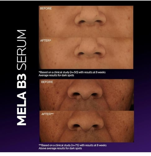 لاروش بوزيه سيروم ميلا بي 3 للبقع الداكنة 30 مل