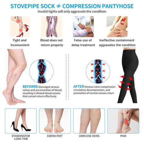 جوارب دوالي ايطالي فوق الركبة مفتوح ضغط 20-30 لون...