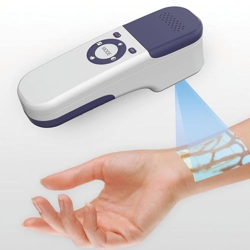 جهاز ذكي ودقيق لتحديد الأوردة بسهولة QV500