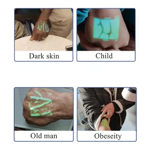 جهاز ذكي ودقيق لتحديد الأوردة بسهولة QV500