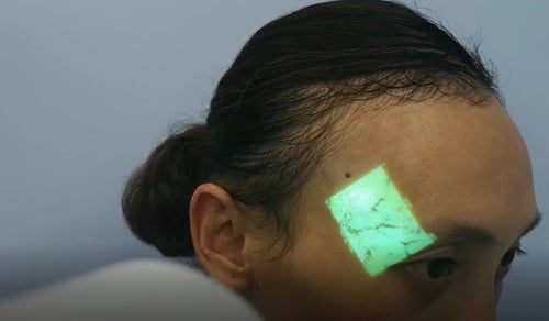 جهاز ذكي ودقيق لتحديد الأوردة بسهولة QV500