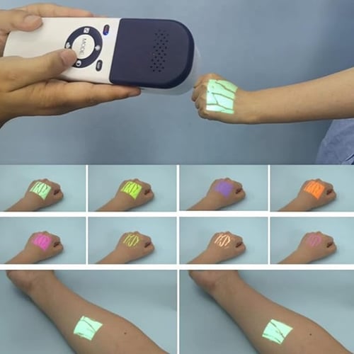 جهاز ذكي ودقيق لتحديد الأوردة بسهولة QV500