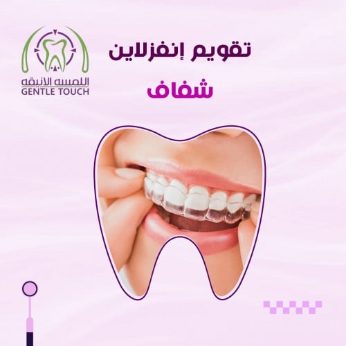 تقويم أنفزلاين