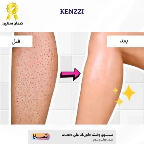 ماكينة كينزي للمناطق الحساسة