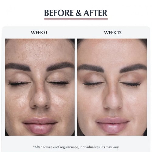 يوسيرين بيغمنت بيرفيكتور رغوة تنظيف البشرة لمكافحة...