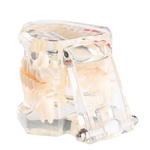 نموذج فك اسنان