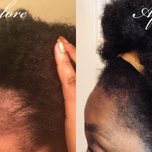 زيت التألق حجم صغير لتحفيز وتطويل الشعر والقضاء ع...