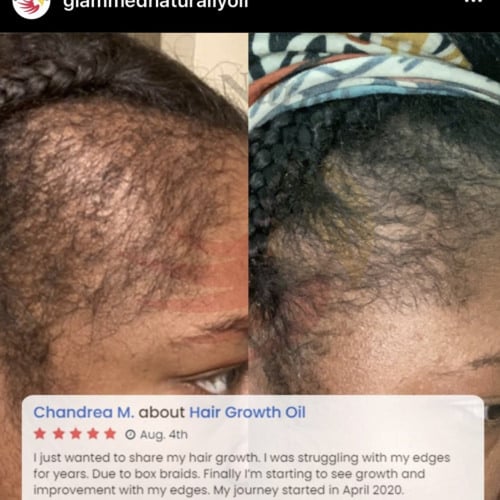 زيت التألق حجم صغير لتحفيز وتطويل الشعر والقضاء ع...