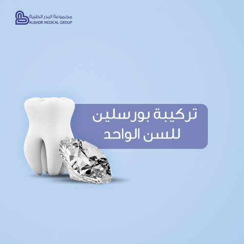 تركيبة بورسلين للسن الواحد