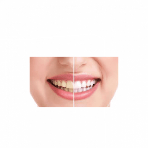 مناديل لتنظيف الاسنان - ويلزياد