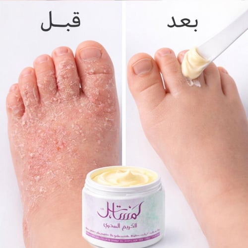 لمسة الشفاء – الكريم السحري بالأعشاب | عرض التوفير...