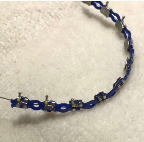 فك تقويم بغرا متصل