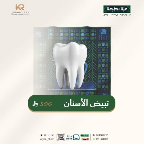 جلسة تبييض الأسنان
