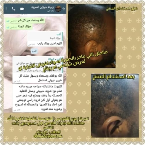 تجارب وصور الكورسات العلاجية