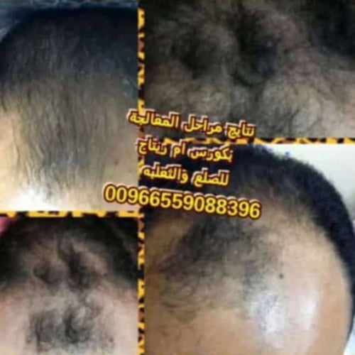 تجارب وصور الكورسات العلاجية