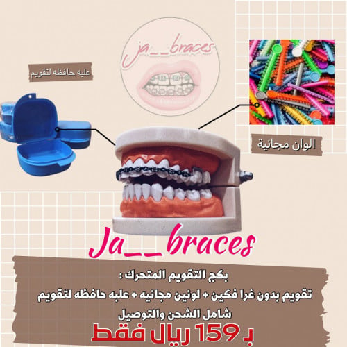 تقويم اسنان زينة (بكج) فكين متصل بدون غر " شامل الشحن "
