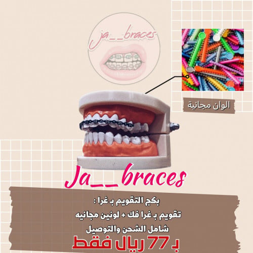 تقويم اسنان زينة (بكج) فك بغرا منفصل " شامل الشحن "