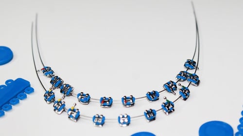 لون تقويم للفكين