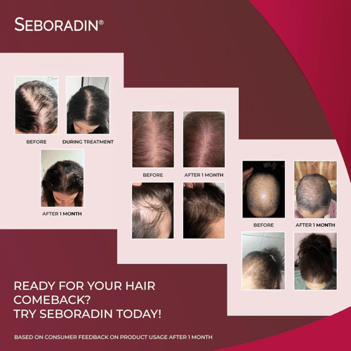 امبولات للعناية بالشعر المتساقط من سيبور ادين 14 ا...