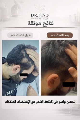 باكج Dr. NAD المتكامل للشعر