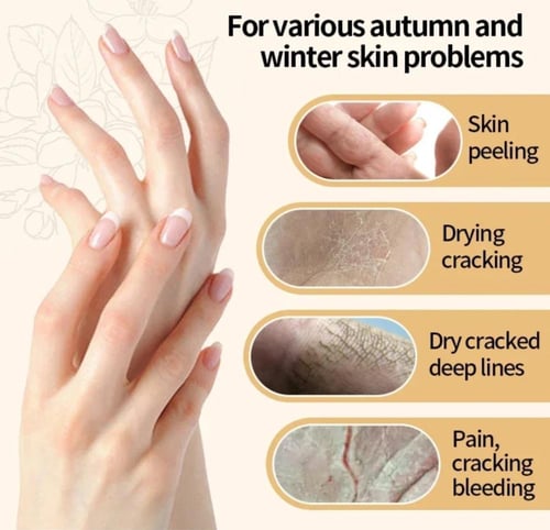 كريم لليدين مضاد للتجاعيد من الكولاجين ، تبييض ، ت...