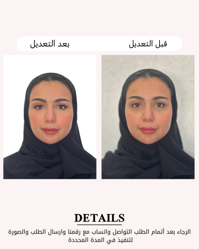 تعديل صورة الأحوال ( تجديد فقط )