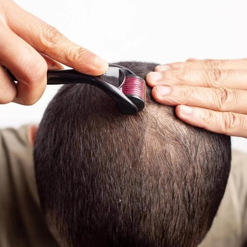 ديرما رولر 540 ابرة Derma Roller