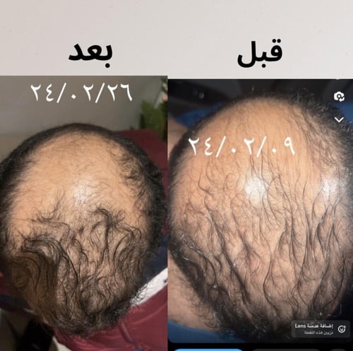 باكيج : ( حناء + سدر ) كازانون