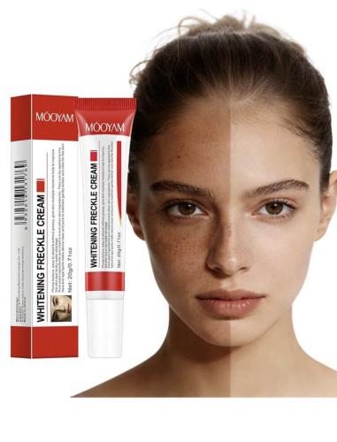 كريم ازالة البقع والكلف والنمش والبثور