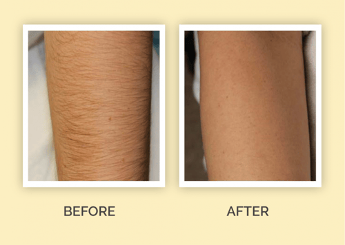 القفاز الحريري ( السحري )