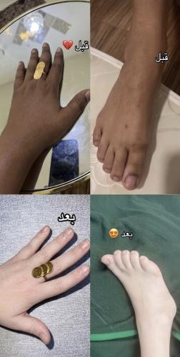 بكج العيد الاقتصادي