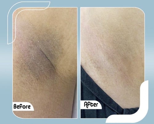 كريم تريبل أكت للبشرة الحساسة والمناطق الحساسة