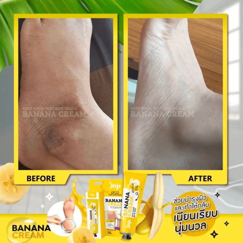 كريم جوچي سيكرت يانغ – لتنعيم وعناية الكعبين بخلاص...