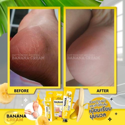 كريم جوچي سيكرت يانغ – لتنعيم وعناية الكعبين بخلاص...