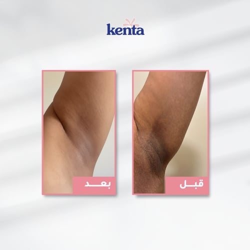 مجموعة كينتا بخلاصة زيت الورد