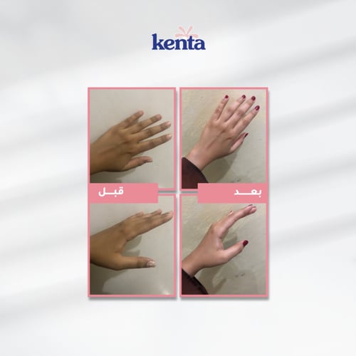 مجموعة كينتا بخلاصة زيت الورد