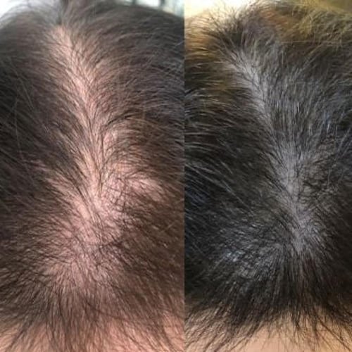 برنامج مسار العناية بالشعر