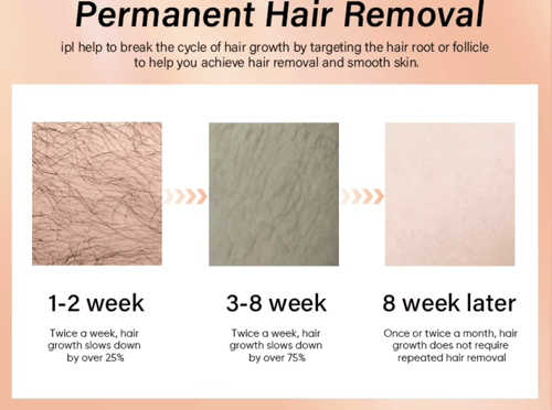 جهاز الليزر العالمي من شركة (كودو KODO) ماركة عالم...