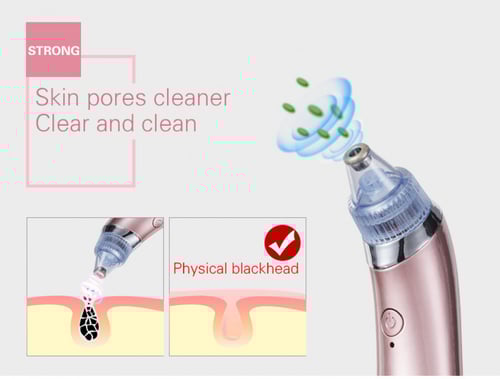 منظف مسام الوجه و مزيل الرؤوس السوداء بطريقة الشفط...