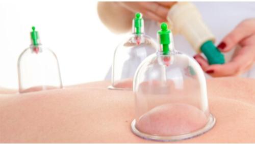 دورة تأهيل ممارسي الحجامة فئات مساعدة 28 / سبتمبر...