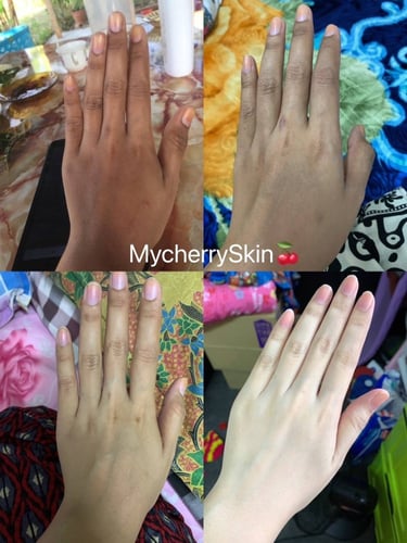 MY CHERRY SKIN